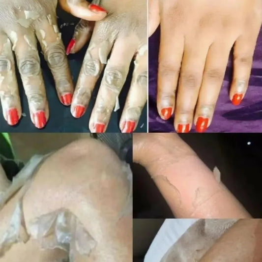 Strong Yellow Peeling Oil Bleach Dark Skin Whiten Lotion