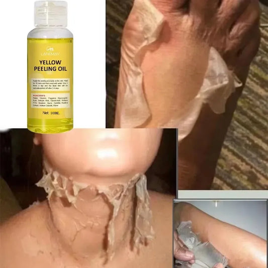 Strong Yellow Peeling Oil Bleach Dark Skin Whiten Lotion