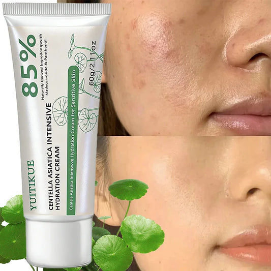 Cream 85% Intensive Hydration Repair for Sensitive Skin