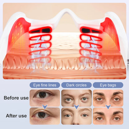 Electric Eye Massager Under-Eye Glasses Massager Eye Fatigue Relief Massager Red Light Relieves